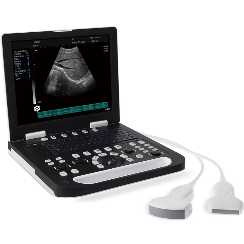 Full Digital Veterinary Scanner